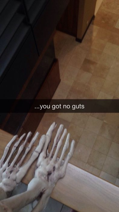 This Guy's Sad Story About His Skull Became A Snapchat Sensation (8 pics)