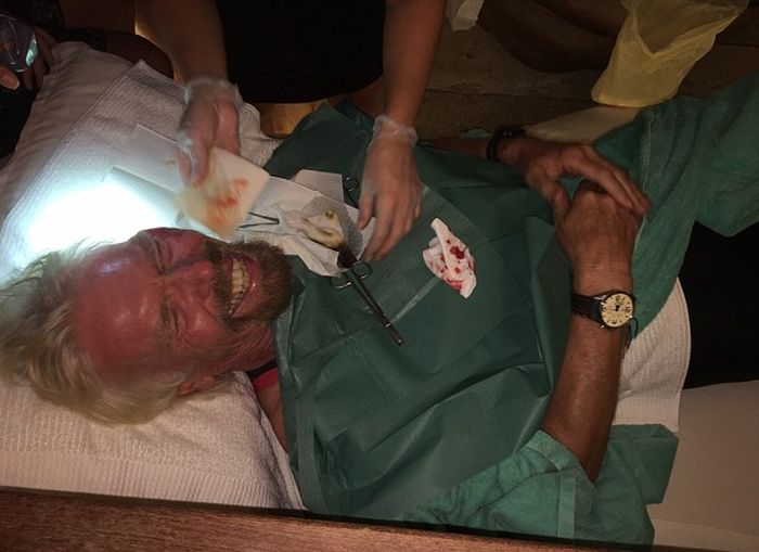 Richard Branson Receives Medical Attention After Brutal Bike Crash (7 pics)