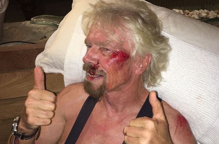 Richard Branson Receives Medical Attention After Brutal Bike Crash (7 pics)