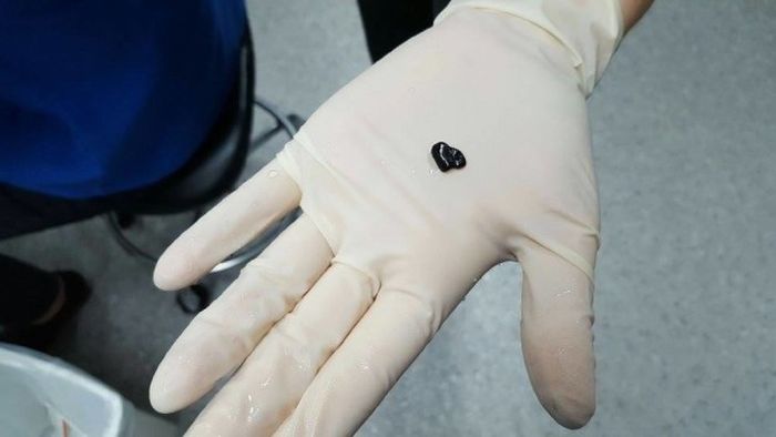 Woman Spends $500 On Surgery For Her Goldfish (7 pics)