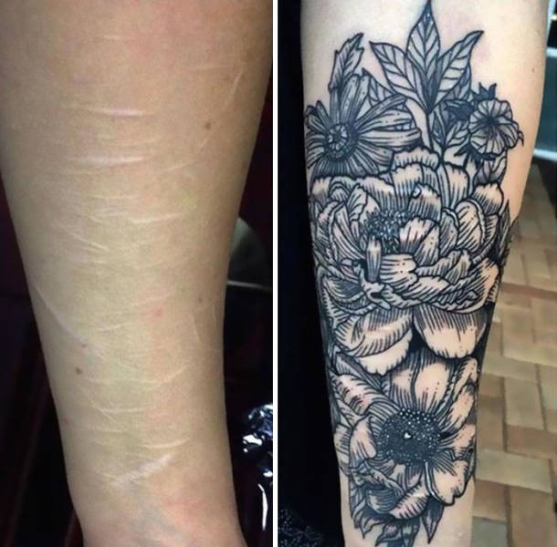 Amazing Tattoos That Covered Up Scars With Interesting Stories (34 pics)