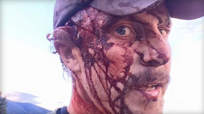 Montana Man Gets Mauled By A Grizzly Bear (4 pics + video)