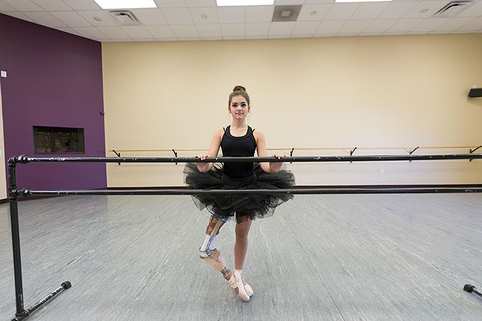 Teenage Amputee Ballerina Makes An Incredible Recovery (5 pics)