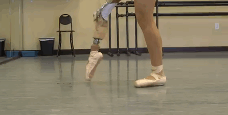Teenage Amputee Ballerina Makes An Incredible Recovery (5 pics)