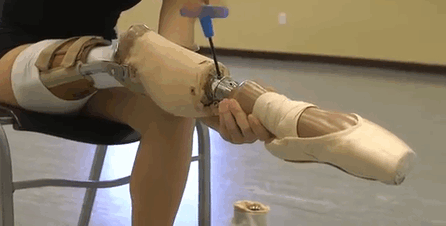 Teenage Amputee Ballerina Makes An Incredible Recovery (5 pics)