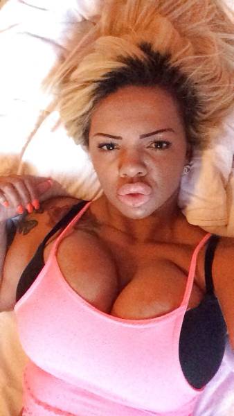 If You Want A Face Like This You Just Have To Get Lots Of Lip Injections (21 pics)