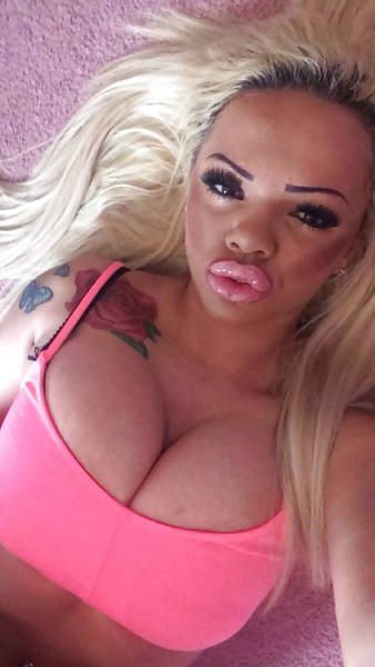 If You Want A Face Like This You Just Have To Get Lots Of Lip Injections (21 pics)