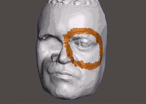 Brazlians Create Incredible Facial Prosthesis Using A 3D Printer (3 pics)