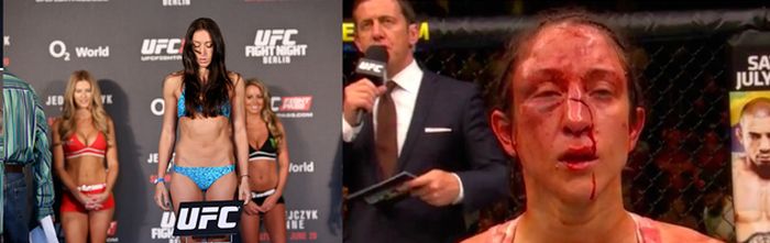 Joanna Jedrzejczyk’s Opponents Before And After (6 pics)