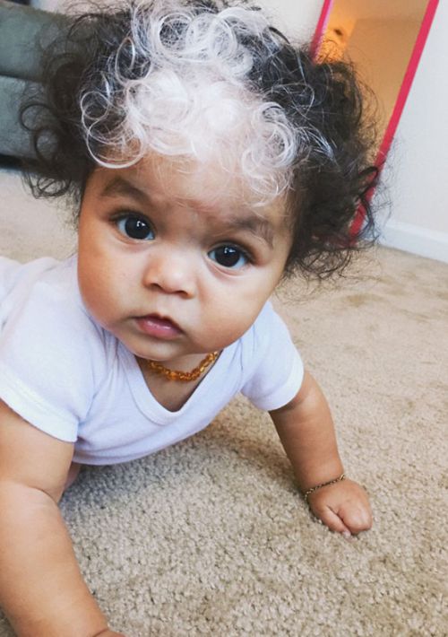 Little Girl Born With A White Patch Of Hair Just Like Her Mom (7 pics)