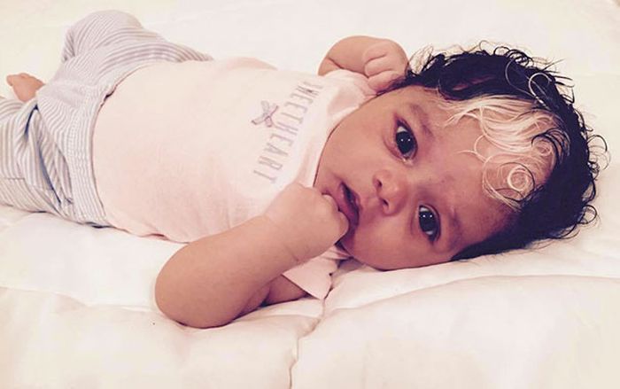 Little Girl Born With A White Patch Of Hair Just Like Her Mom (7 pics)