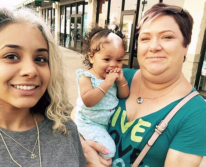 Little Girl Born With A White Patch Of Hair Just Like Her Mom (7 pics)