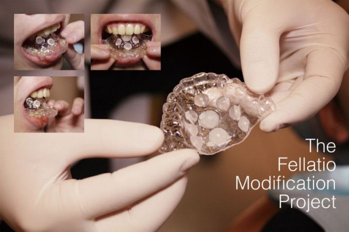 Dentist Creates A Prothesis Designed To Enhance Blowjobs (5 pics)