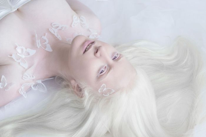 You'll Be Amazed By These Albino People And Their Unique Beauty (32 pics)