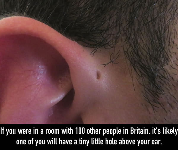 The Reason Why Some People Have Little Holes Above Their Ears (5 pics)