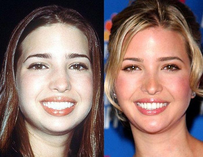 Photos Show How Much Ivanka Trump Has Changed Over The Years (10 pics)