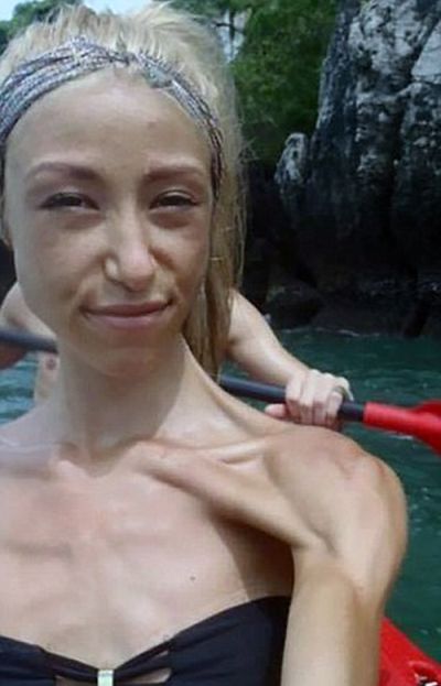 Woman With Eating Disorder Turns It Around To Become A Bodybuilder (11 pics)