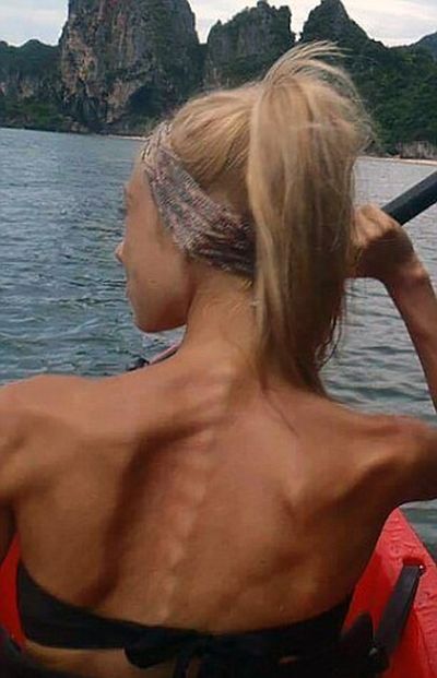 Woman With Eating Disorder Turns It Around To Become A Bodybuilder (11 pics)