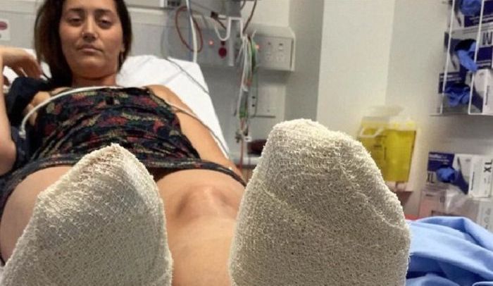 Aussie Girl Gets A Gross Surprise After Running On The Beach (2 pics)