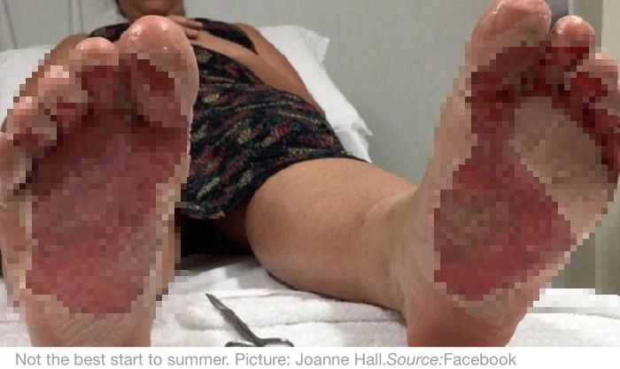 Aussie Girl Gets A Gross Surprise After Running On The Beach (2 pics)