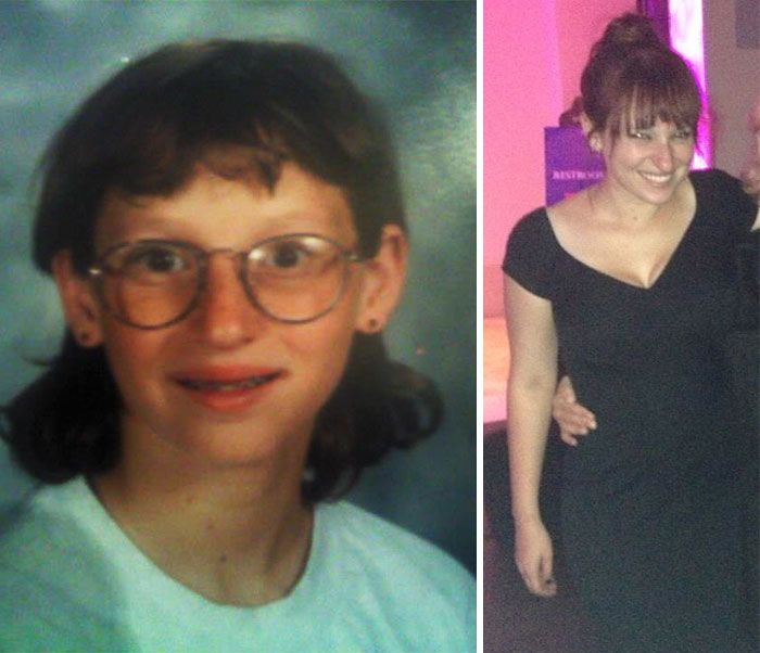 People Share Their Unbelievable Ugly Duckling Transformations (30 pics)