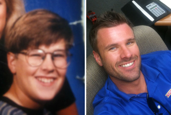 People Share Their Unbelievable Ugly Duckling Transformations (30 pics)