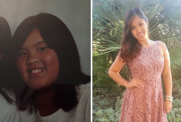 People Share Their Unbelievable Ugly Duckling Transformations (30 pics)