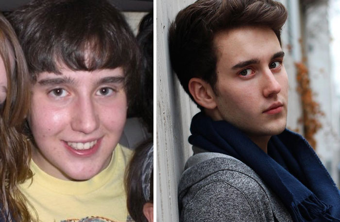 People Share Their Unbelievable Ugly Duckling Transformations (30 pics)