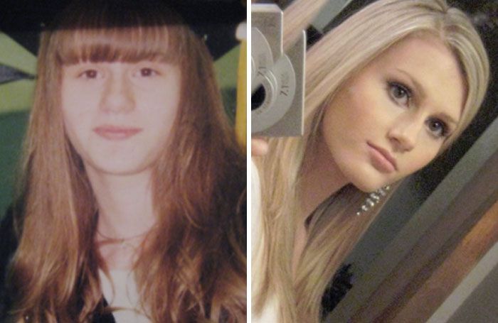 People Share Their Unbelievable Ugly Duckling Transformations (30 pics)