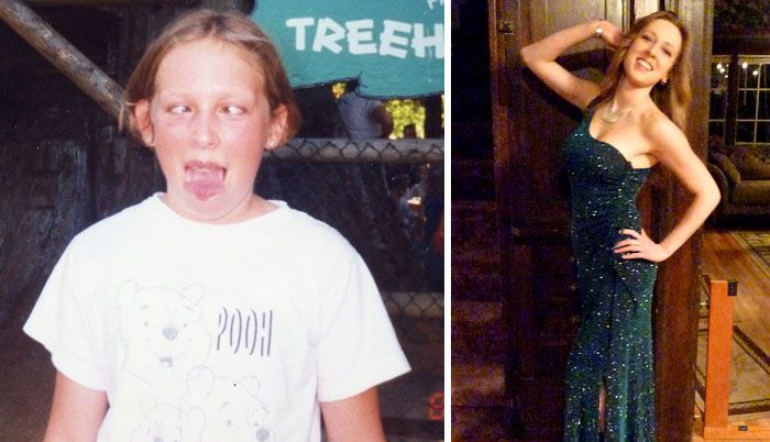 People Share Their Unbelievable Ugly Duckling Transformations (30 pics)