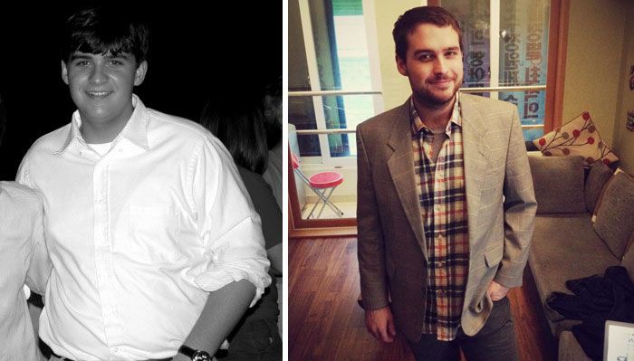 People Share Their Unbelievable Ugly Duckling Transformations (30 pics)