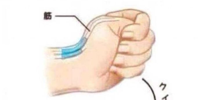 How To Dislocate Your Thumb (14 pics)