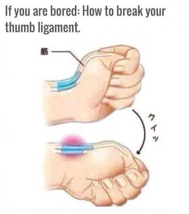 how-to-dislocate-your-thumb-14-pics