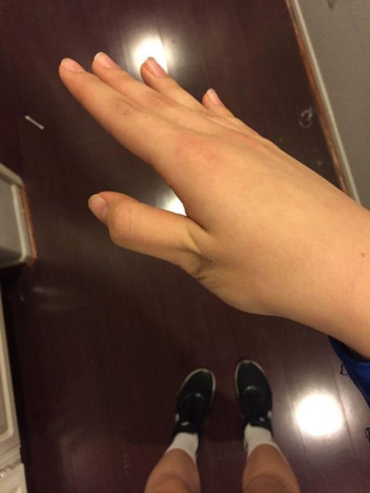 How To Dislocate Your Thumb (14 pics)