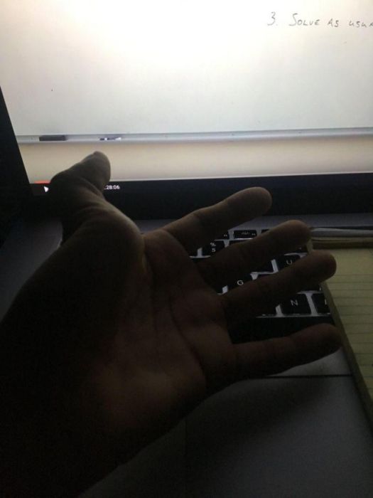 How To Dislocate Your Thumb (14 pics)