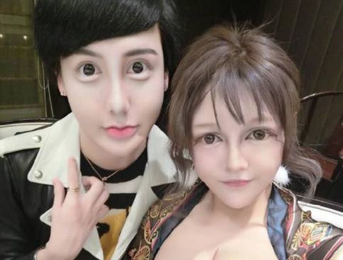 People Who Took Plastic Surgery Way Too Far (5 pics)