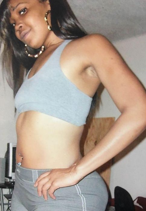 Woman Uses Illegal Injections To Enhance Her Butt Size (8 pics)