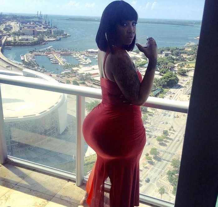 Woman Uses Illegal Injections To Enhance Her Butt Size (8 pics)
