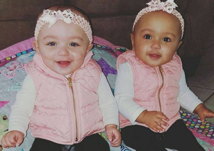 These Adorable Twin Sisters Have Defied The Laws Of Nature (5 pics)