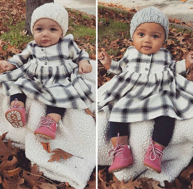 These Adorable Twin Sisters Have Defied The Laws Of Nature (5 pics)