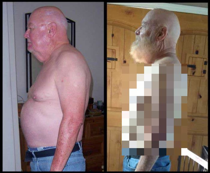 Elderly Man Shares Stunning Weight Loss Photos (2 pics)