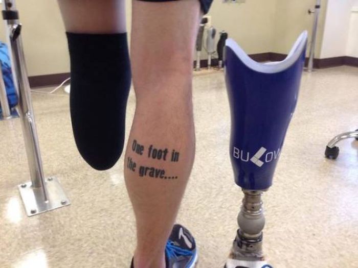 Losing Your Limbs Doesn’t Mean You Lose Your Passion For Life (36 pics)