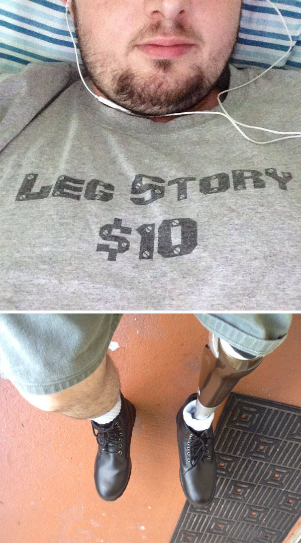 Losing Your Limbs Doesn’t Mean You Lose Your Passion For Life (36 pics)