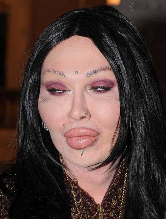 Irreversible Plastic Surgery Fails That Are Straight Up Scary (39 pics)