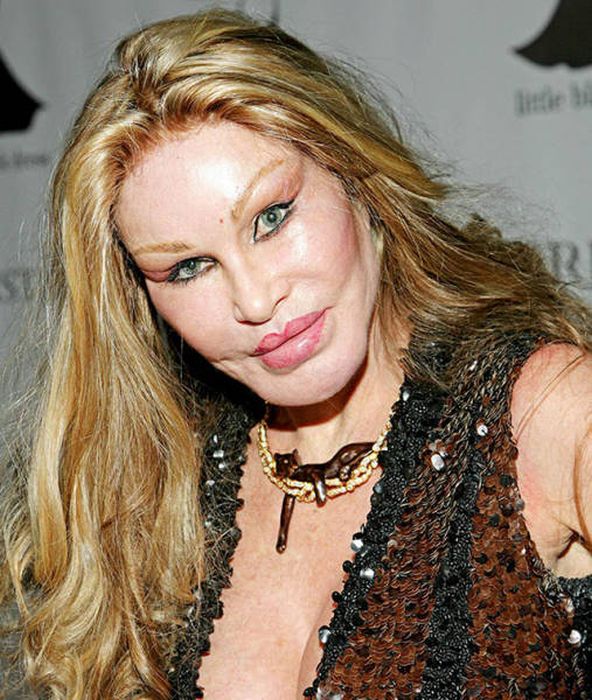 Irreversible Plastic Surgery Fails That Are Straight Up