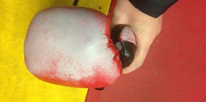 Boxer Tries To Cheat Using Enhanced Grant Gloves (2 pics)