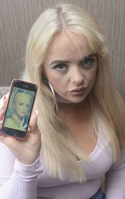 This Woman Will Never Try To Save Money On Plastic Surgery Again (8 pics)