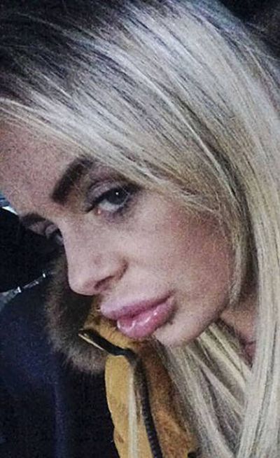 This Woman Will Never Try To Save Money On Plastic Surgery Again (8 pics)