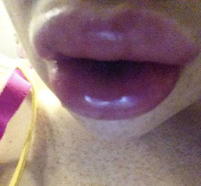 This Woman Will Never Try To Save Money On Plastic Surgery Again (8 pics)
