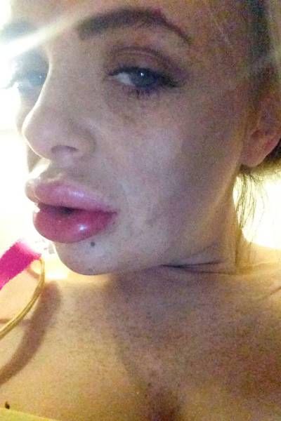 This Woman Will Never Try To Save Money On Plastic Surgery Again (8 pics)